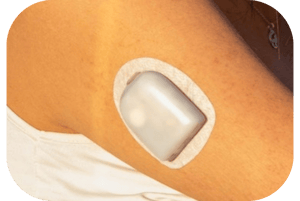 wearable skin device
