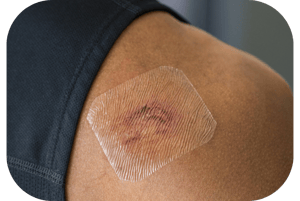 custom medical adhesive tape